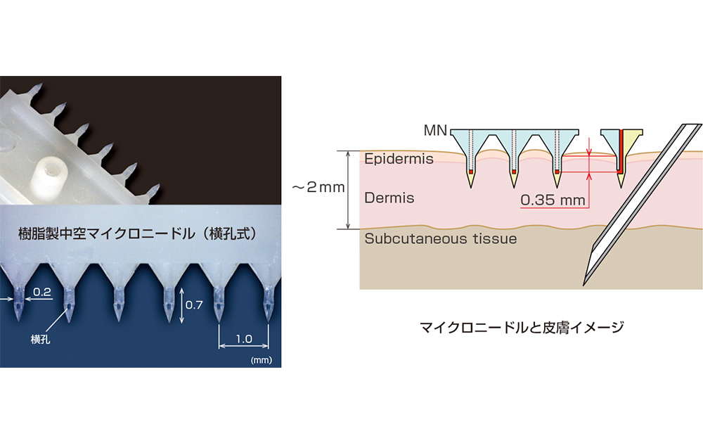 マイクロニードル