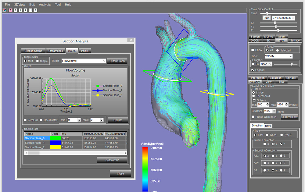 血流解析プログラムによる流れ場の可視化